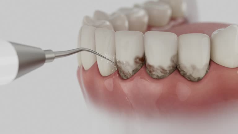 Trusted Emergency Dentist service in Glenrock, WY - Dentist Open Now